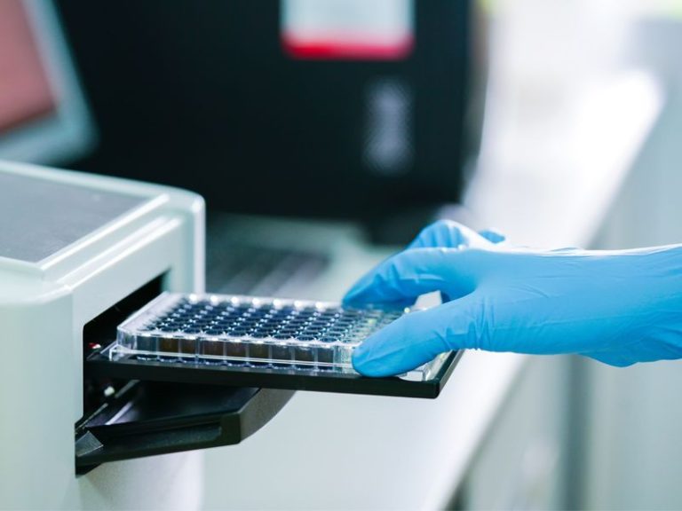 Read more about the article ELISA (Enzyme-Linked Immunosorbent Assay): Principle, Types, and Step-by-Step Protocol