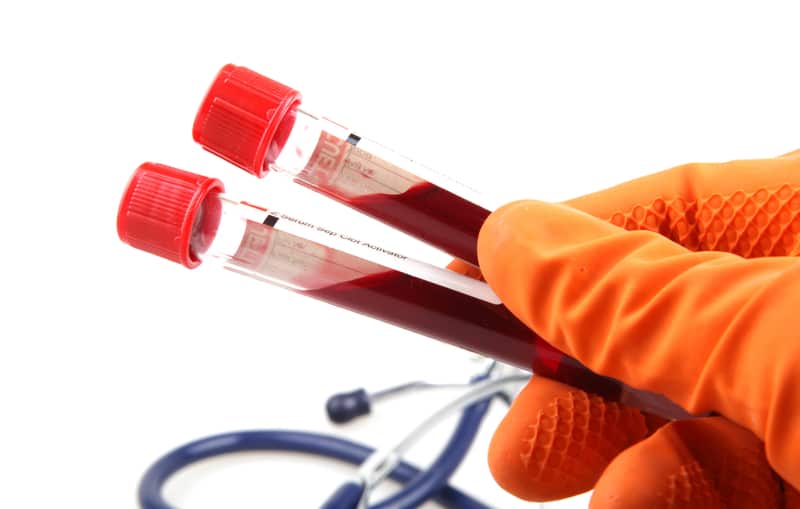 Read more about the article ELISA Blood Samples: Serum vs Plasma - Key Differences, Preparation & Hemolysis Effects
