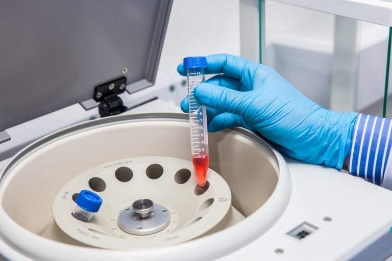Read more about the article 5 - High Background in ELISA? Causes and Solutions for Optimal Results